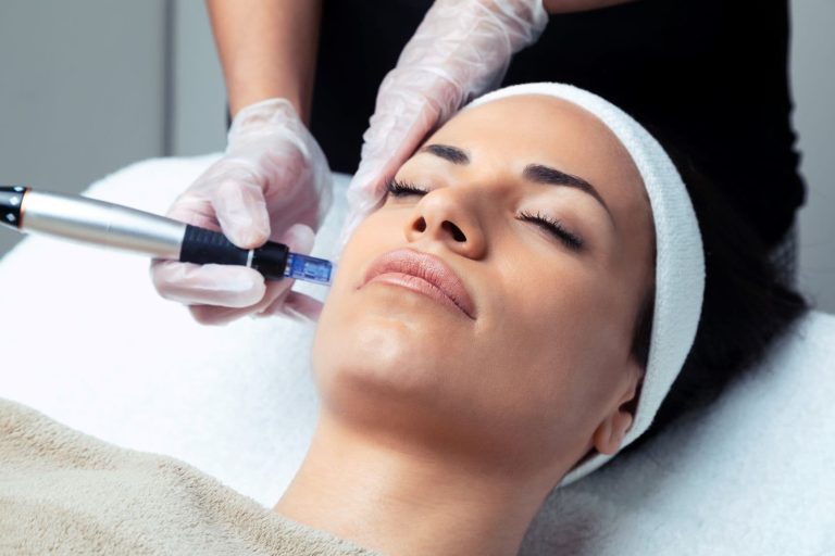 How Much Microneedling under the Eye Costs? Procedure and More
